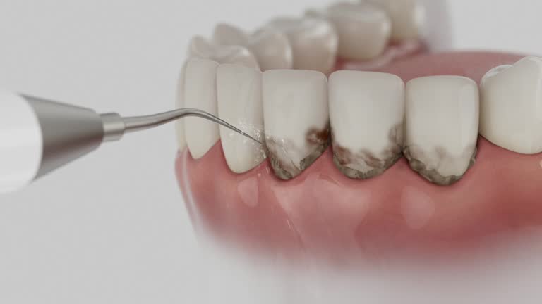 Reliable Teeth Cleaning And Checkup contractor in Wilkinson County County, GA by Dentist Open Now